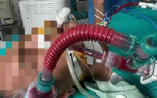 Thoát chết ngoạn mục nhờ nút tắc động mạch vú trong hiếm gặp